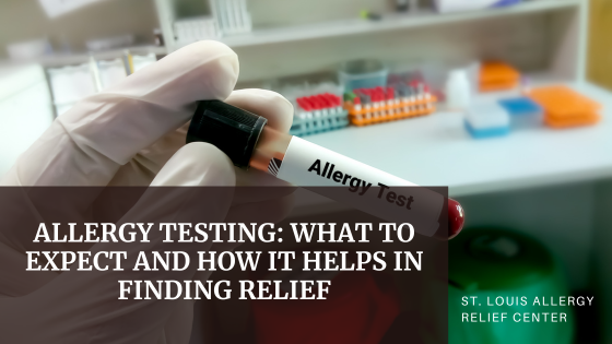 Allergy testing what to expect and how it helps in finding relief